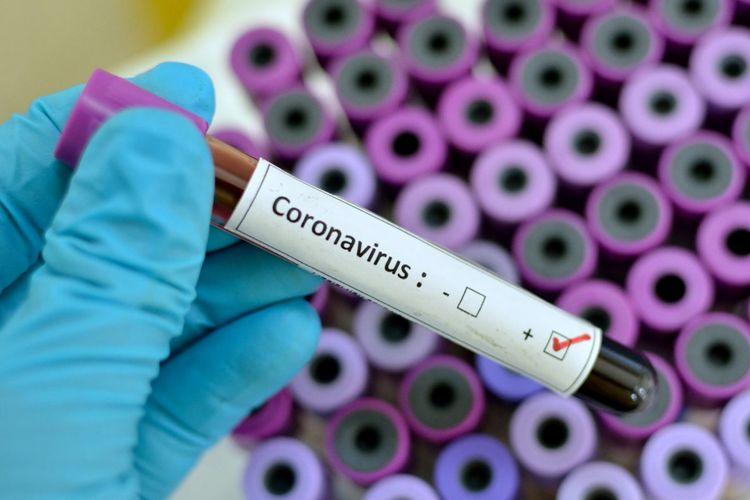 Azərbaycanda koronavirusa yoluxanların sayı 641-ə çatdı, 44 nəfər sağalıb<b style="color:red"></b>