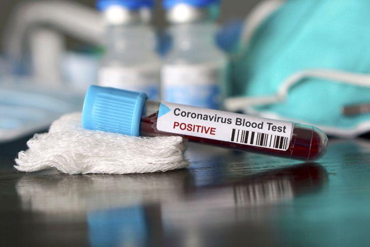 İndiyədək 5662 nəfər koronavirusa yoluxub: <b style="color:red">3508 sağalan, 68 ölən var </b>