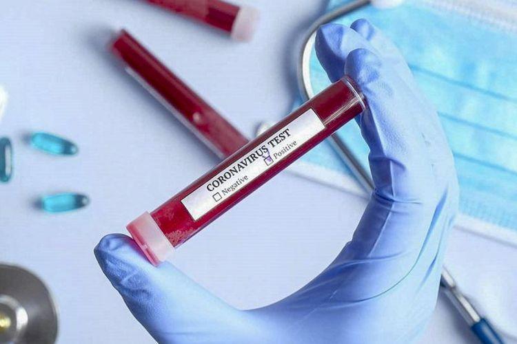 Ümumilikdə 495 828 koronavirus testi aparılıb<b style="color:red"></b>