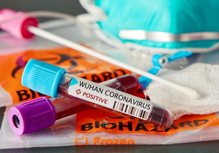 Daha 792 nəfərdə koronavirus aşkarlandı: <b style="color:red">220 sağalan, 8 ölən var</b>