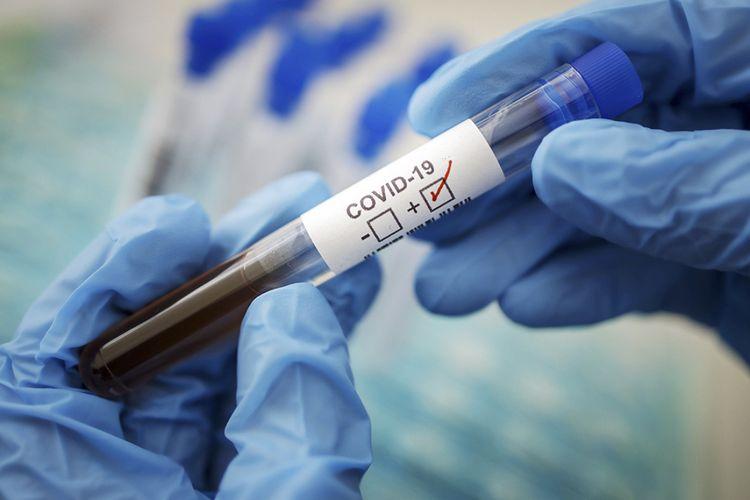 Aparılmış koronavirus testinin sayı 245 mini ötdü