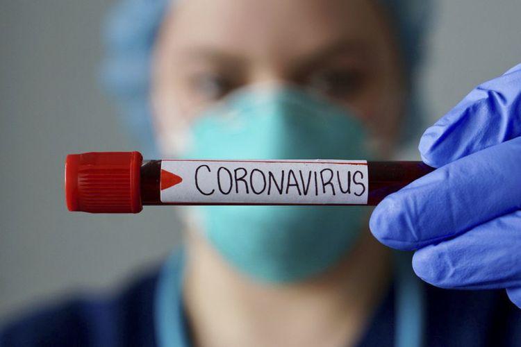 Mingəçevir şəhər Təhsil Şöbəsinin müdiri koronavirusa yoluxdu