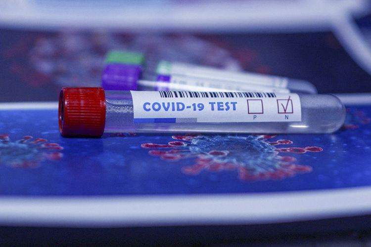 Qırğızıstanın Prezident Aparatının rəhbəri və daha 16 əməkdaşı koronavirusa yoluxdu