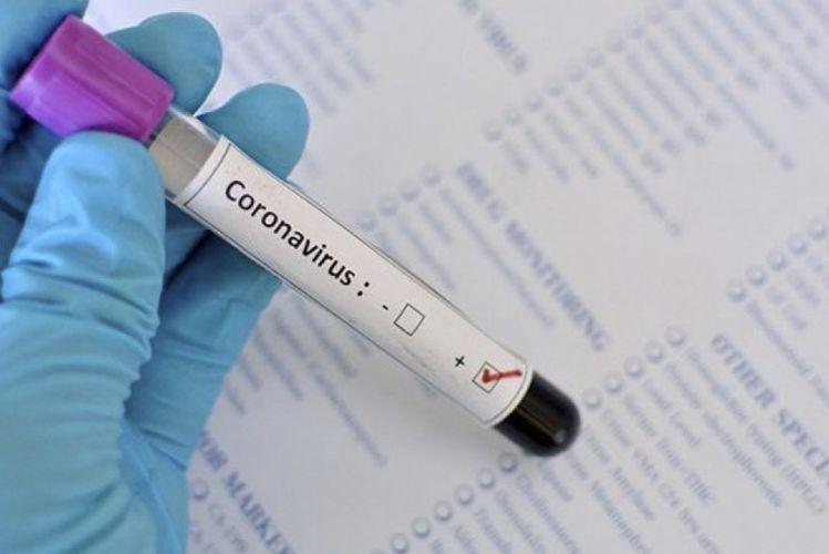 İndiyədək 1646654 koronavirus testi aparılıb