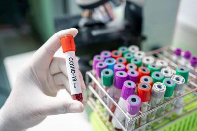44 yeni koronavirusa yoluxma faktı qeydə alındı:  65 nəfər sağalıb, 1 nəfər vəfat edib