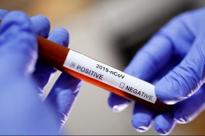 Daha 33 yeni koronavirusa yoluxma faktı qeydə alındı:  23 nəfər sağalıb