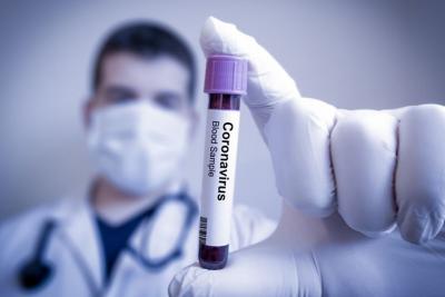 Son günlər koronavirusa daha çox yoluxma olan kəndlərin adları açıqlandı