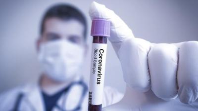 Koronavirusun daha bir simptomu aşkar edildi