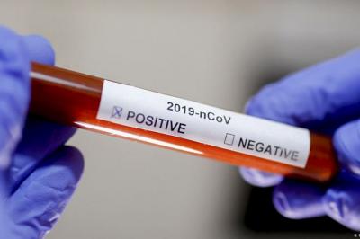 Indiyədək aparılmış koronavirus testlərinin sayı açıqlandı