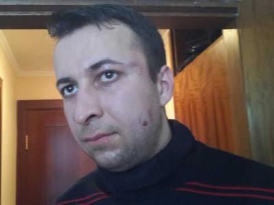 Kiyevdə azərbaycanlı jurnalist döyülüb - FOTO