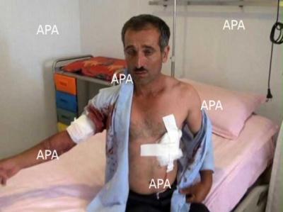 Cəlilabad sakini atasını və bacısını bıçaqlayıb