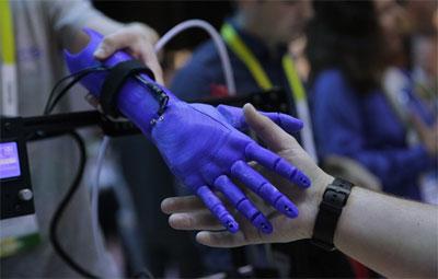 Kolumbiyada protezlərin hazırlanmasında “3D” texnologiyasından istifadə edilir