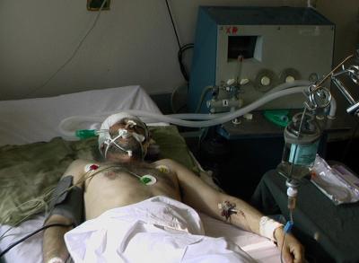 Gürcüstan daxili işlər nazirinin sabiq müavini güllələnib