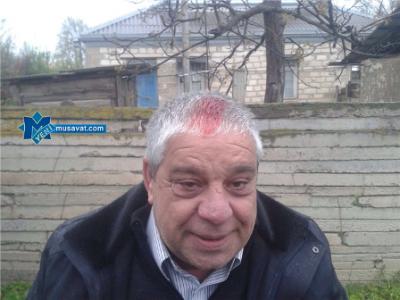Cəbhə bölgəsinə yollanan QAT üzvü başından yaralanıb