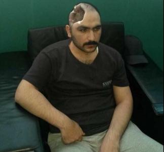 "Aprel döyüşlərində yaralanan hərbçi Türkiyəyə aparılacaq"