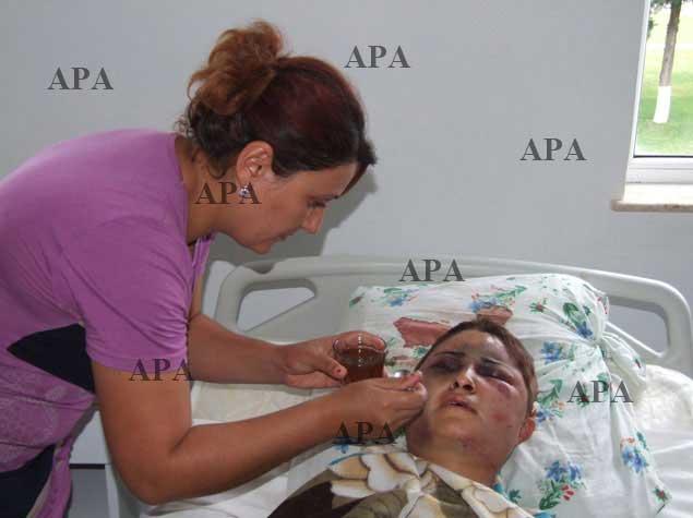 Ər arvadına dəhşətli işgəncələr verdi, saçlarını kəsdi<b style="color:red"></b>