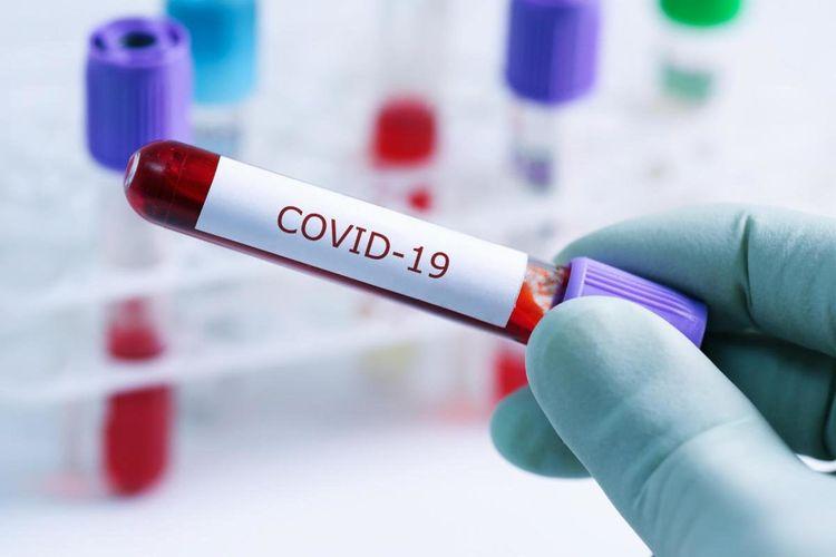  Daha 17 nəfər koronavirusa yoluxdu, 1 nəfər öldü<b style="color:red"></b>