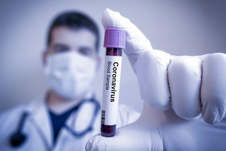 Koronavirusun aktivləşdiyi temperatur müəyyənləşdi<b style="color:red"></b>
