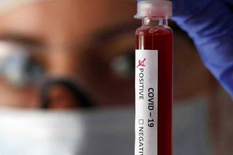 Azərbaycanda koronavirusla əlaqədar 45 mindən artıq test aparılıb<b style="color:red"></b>