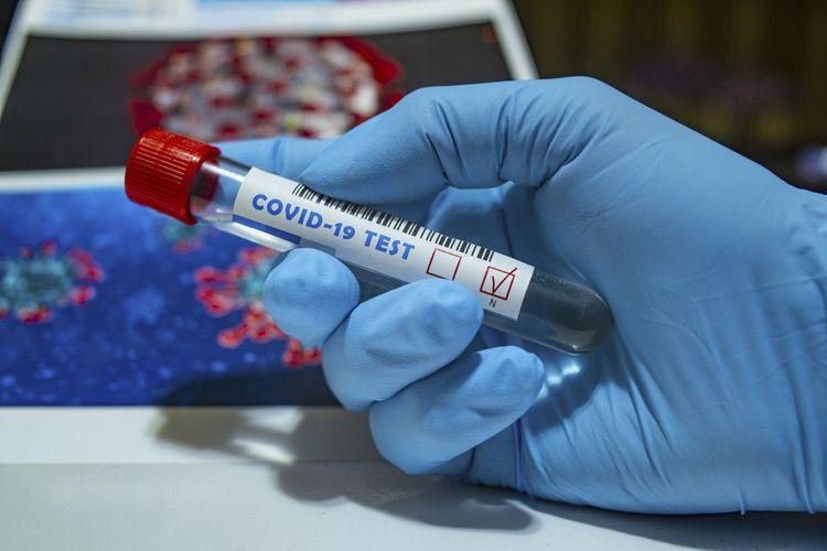 Rusiyada daha bir nazir koronavirusa yoluxdu<b style="color:red"></b>