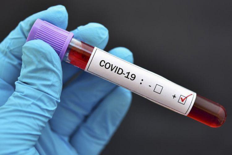 "Koronavirus qanın laxtalanma sisteminə çox ciddi təsir göstərir"<b style="color:red"></b>