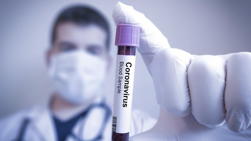 Koronavirusun daha bir simptomu aşkar edildi <b style="color:red"></b>