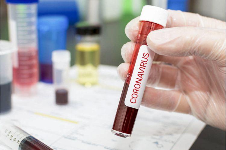 İndiyədək 488852 koronavirus testi aparılıb<b style="color:red"></b>