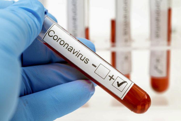Bu günədək 584466 koronavirus testi aparıldı<b style="color:red"></b>