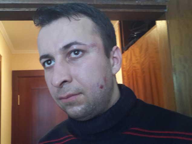 Kiyevdə azərbaycanlı jurnalist döyülüb - <b style="color:red">FOTO</b>