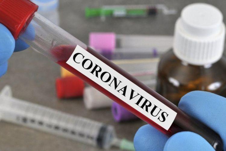 Son sutkada ABŞ-da koronavirusdan 1394 nəfər ölüb<b style="color:red"></b>