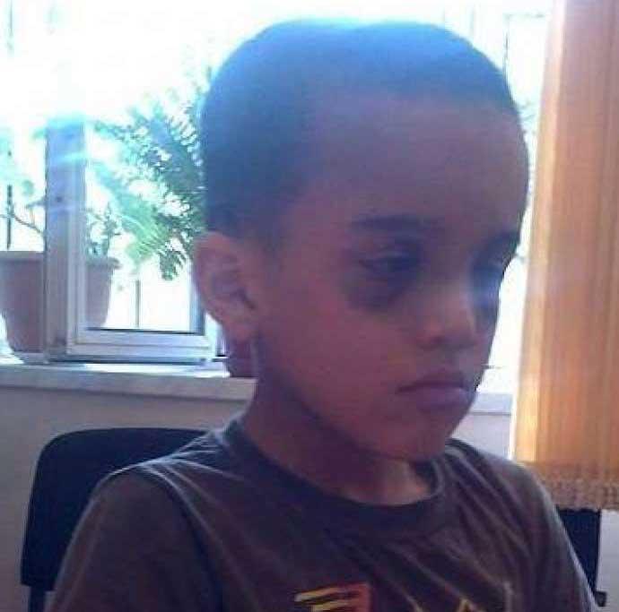 Komitə: “Uşağın döyülməsi faktı təsdiqlənərsə...”<b style="color:red"></b>