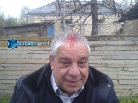 Cəbhə bölgəsinə yollanan QAT üzvü başından yaralanıb<b style="color:red"></b>