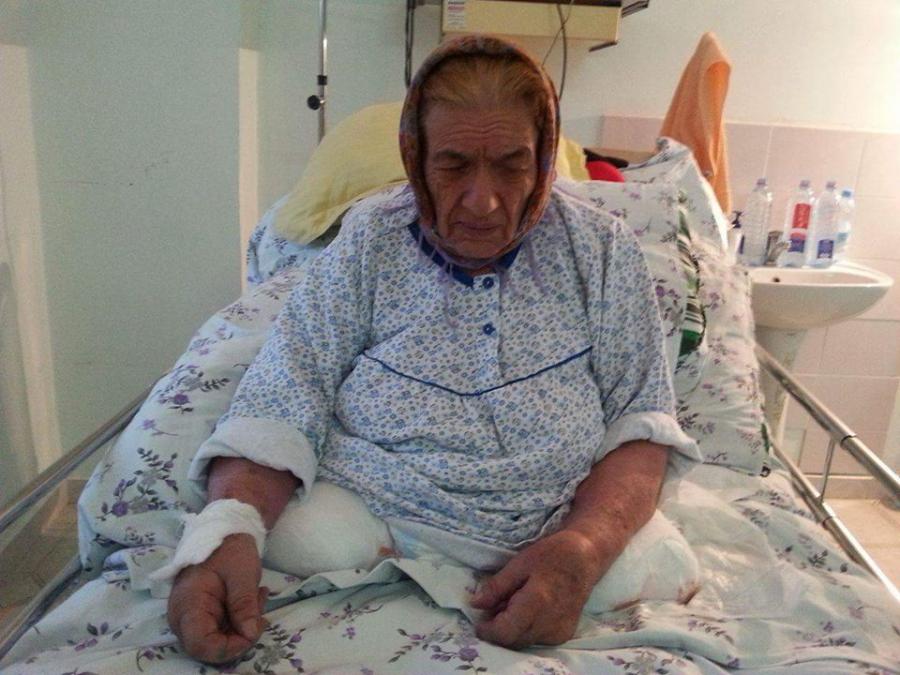 Xəstənin sağlam ayağını kəsən həkim və klinikanın direktoru işdən azad olundu<b style="color:red"></b>
