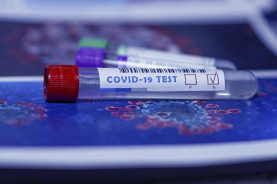 COVİD-19-un laboratoriyadan yayılmasına dair daha bir iddia irəli sürülüb