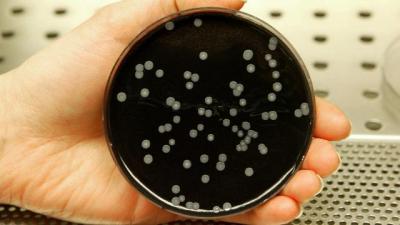 Legionella bakteriyası 6 nəfərin ölümünə səbəb oldu