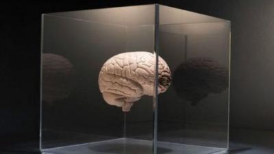 Beyin saxlanılması üçün ilk biobank yaradıldı - Dünyada ilk