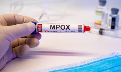 Cənubi Afrikada "mpox"dan ilk ölüm halları qeydə alınıb