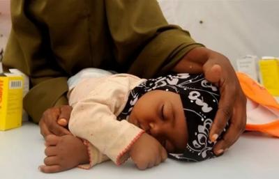 Nigeriyada qızılca epidemiyası -  15 uşaq həyatını itirib